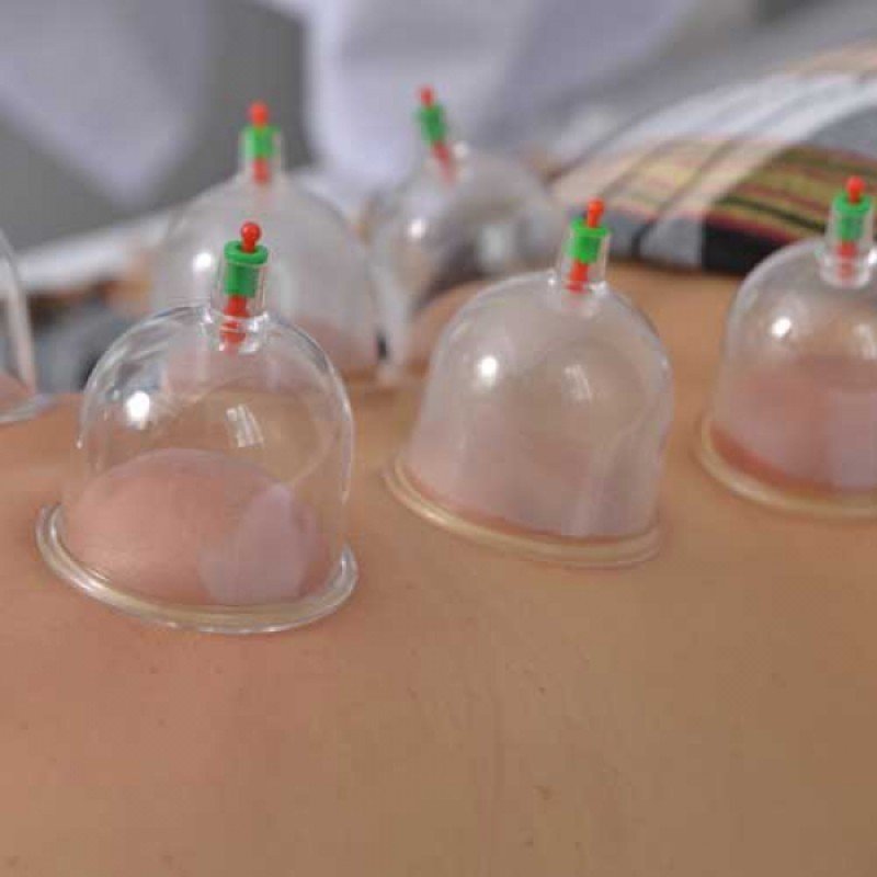 12 Parça Vakumlu Hacamat Kupa Seti - Görsel 3